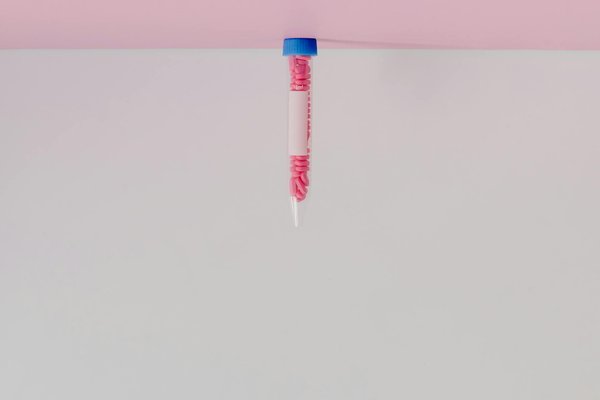 Comment le choix de la méthode d'accouchement peut-il influencer l'expérience de la maternité ?